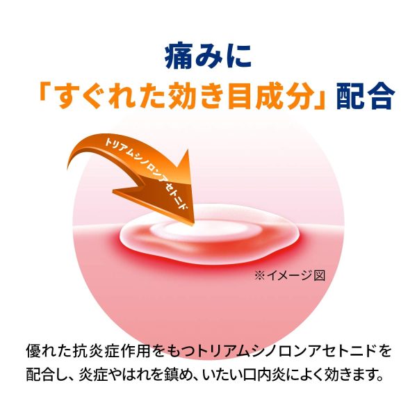 Sato Pharmaceutical Afutaguard 5G Oral Pain Relief Gel - [Class 2 OTC Drug] Hot on Sale - Image 4